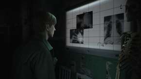 إشاعة: Silent Hill 2 Remake في مراحل الصقل الأخيرة
